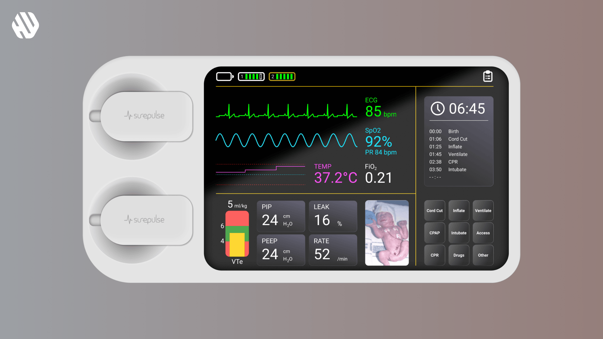 SurePulse medical monitor displaying vital signs and newborn care timeline with product branding visible.